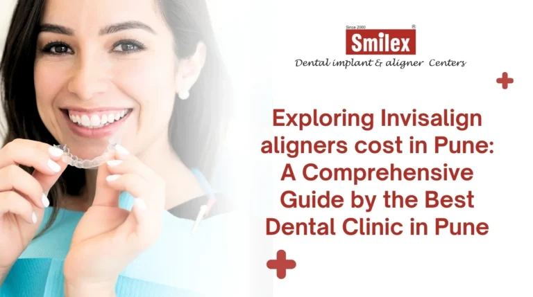 Invisalign aligners cost in Pune