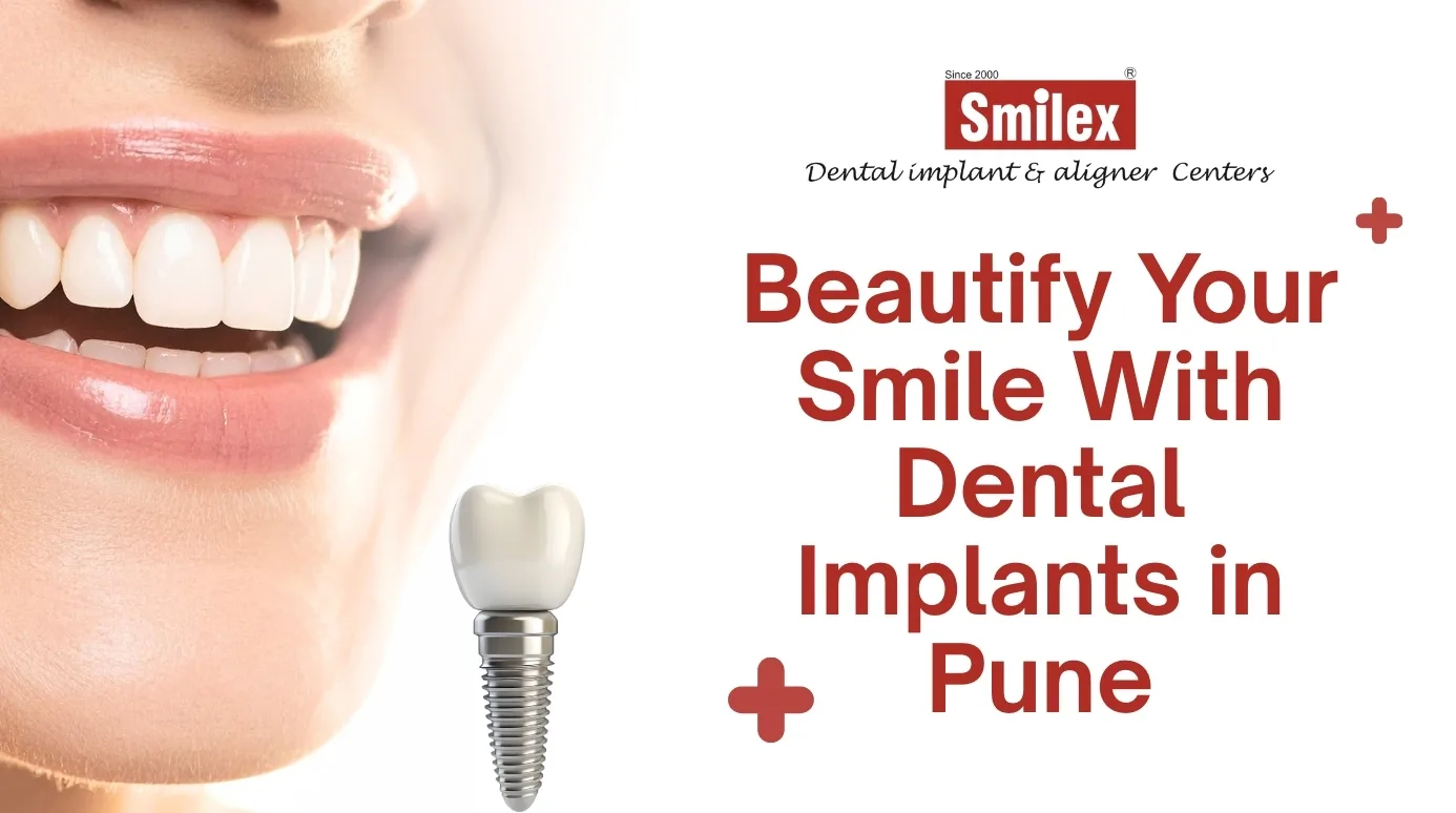 Beautify Your Smile With Dental Implants in Pune