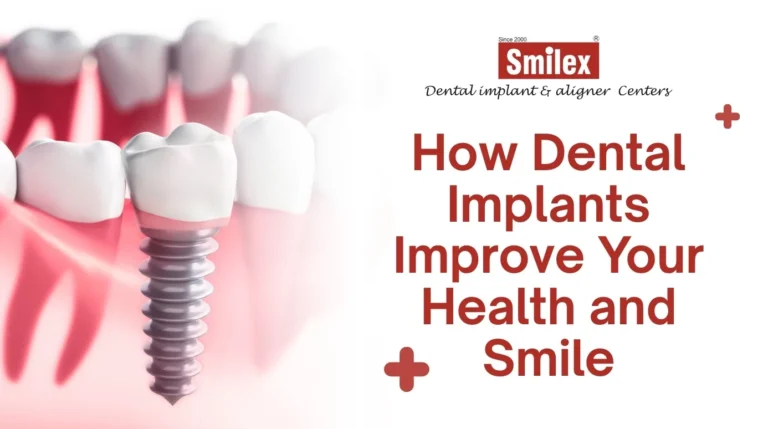 Dental Implants