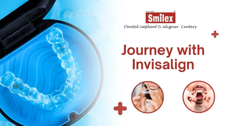 Journey with Invisalign