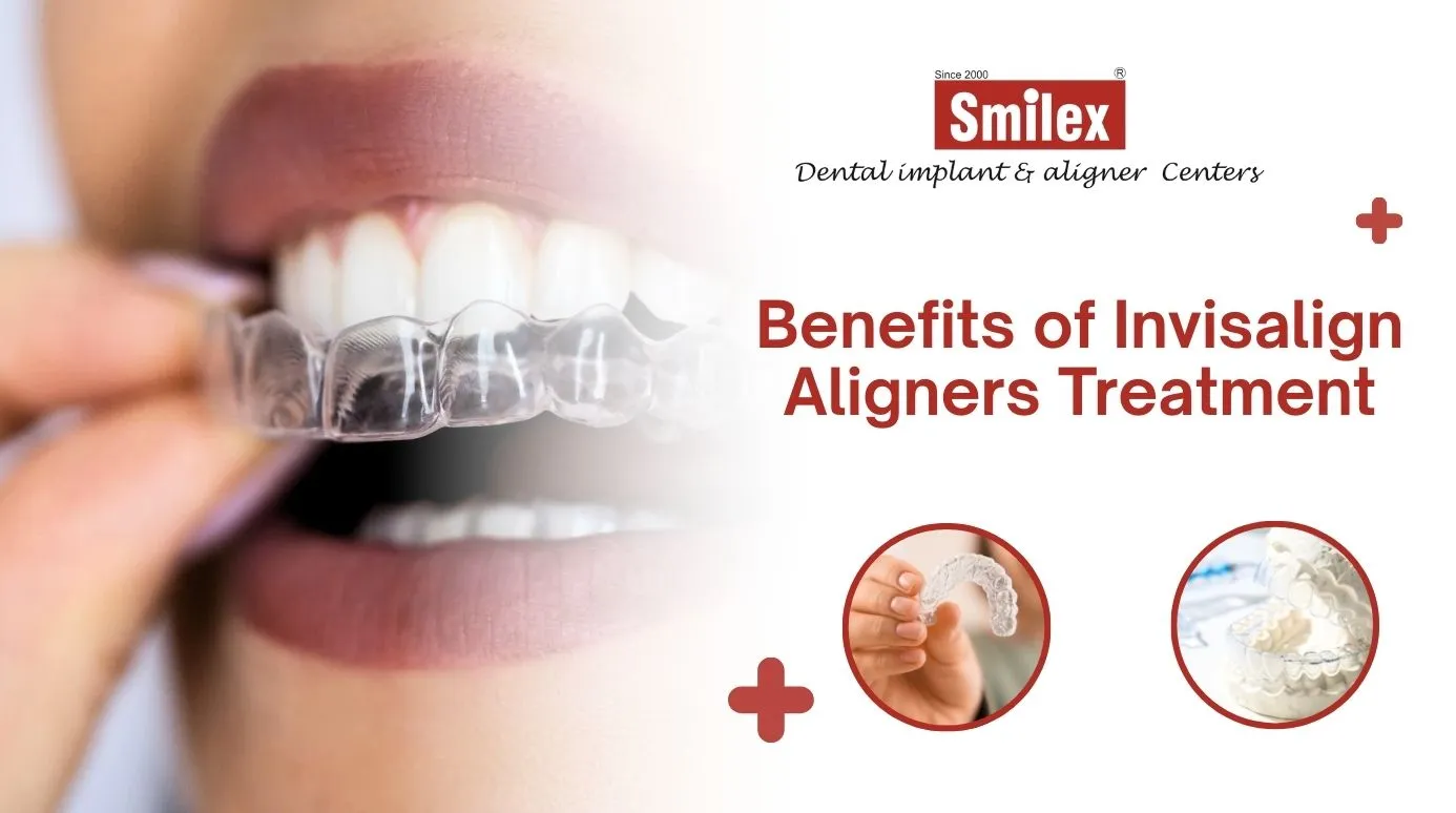 Invisalign Aligners Treatment