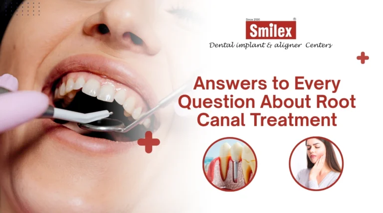 Root Canal Treatment