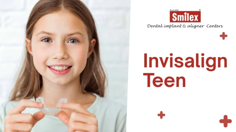 Invisalign Teen