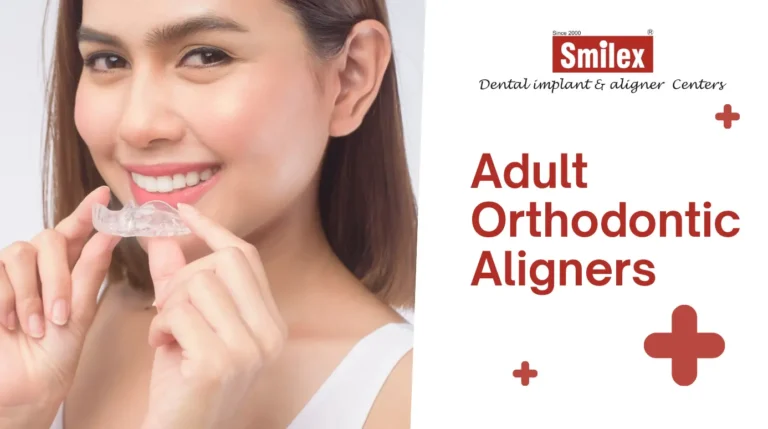 Orthodontic Aligners