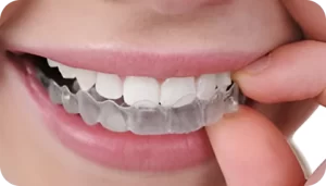 Invisalign