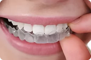 Invisalign
