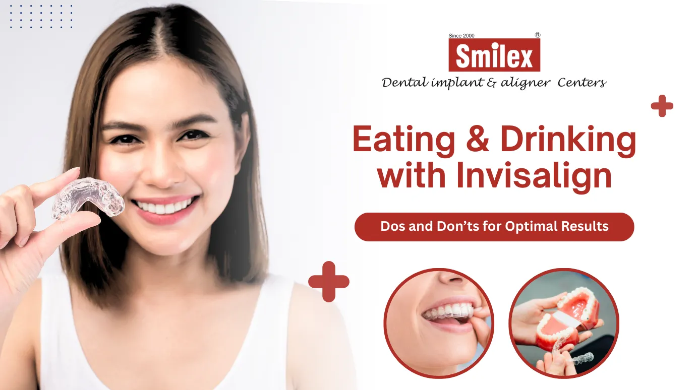 Invisalign
