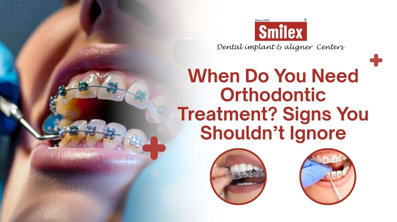 When Do You Need Orthodontic Treatment? Signs You Shouldn’t Ignore