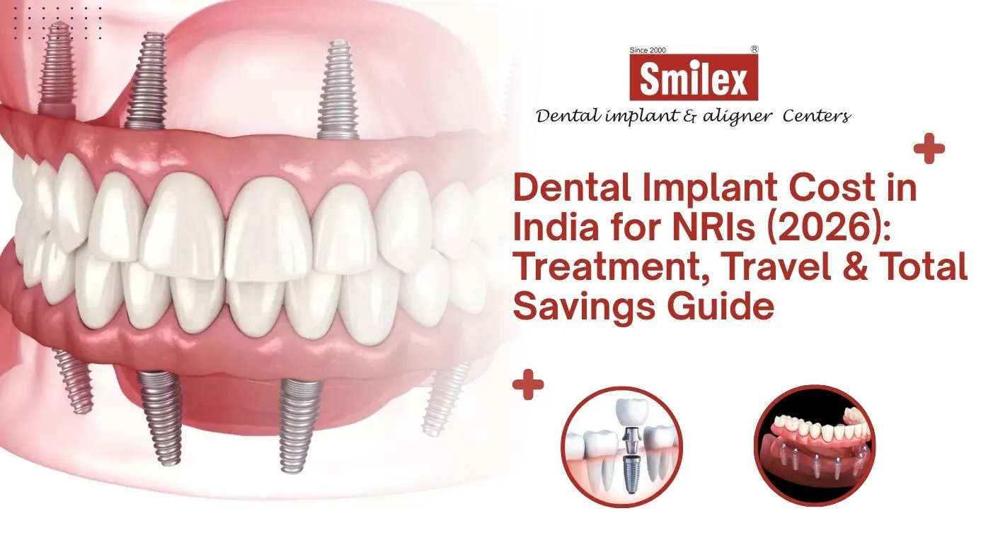 Dental Implant Cost in India for NRIs (2026): Treatment, Travel & Total Savings Guide