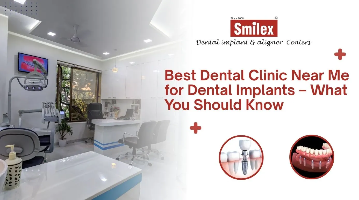 Best Dental Clinic Near Me for Dental Implants – What You Should Know
