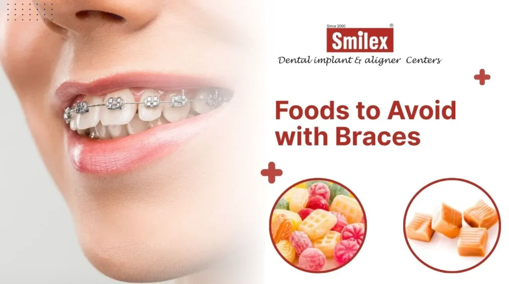 Foods to Avoid with Braces